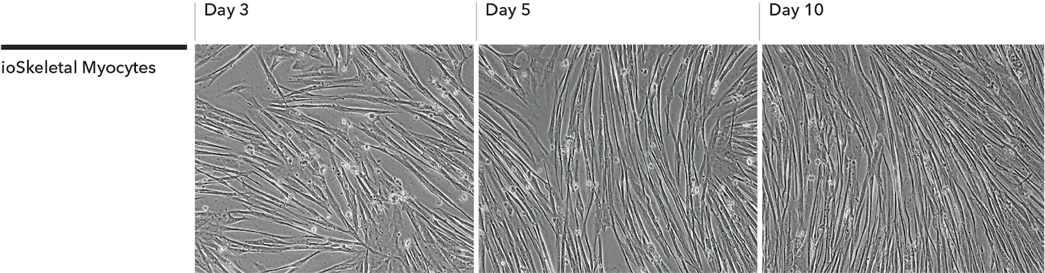 iPSC-derived skeletal myocytes morphology