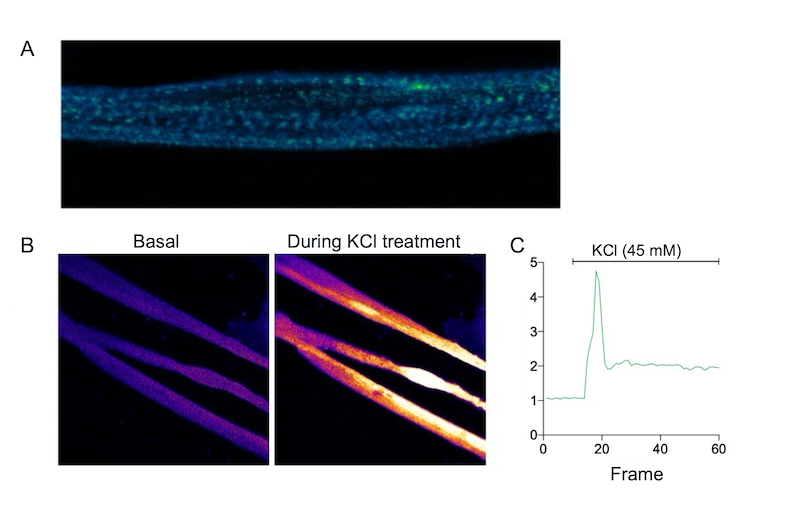 Skeletal myocytes contract in response to KCl
