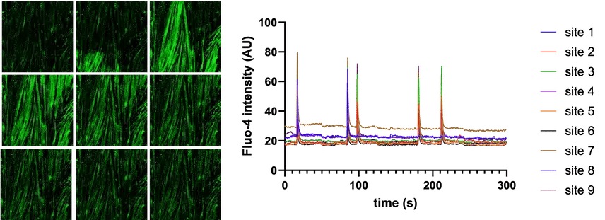 bit.bio-skeletal-myocytes-synchronised-calcium-waves
