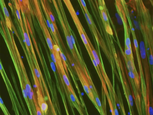 ioSkeletal Myocytes ICC staining protocol | bit.bio