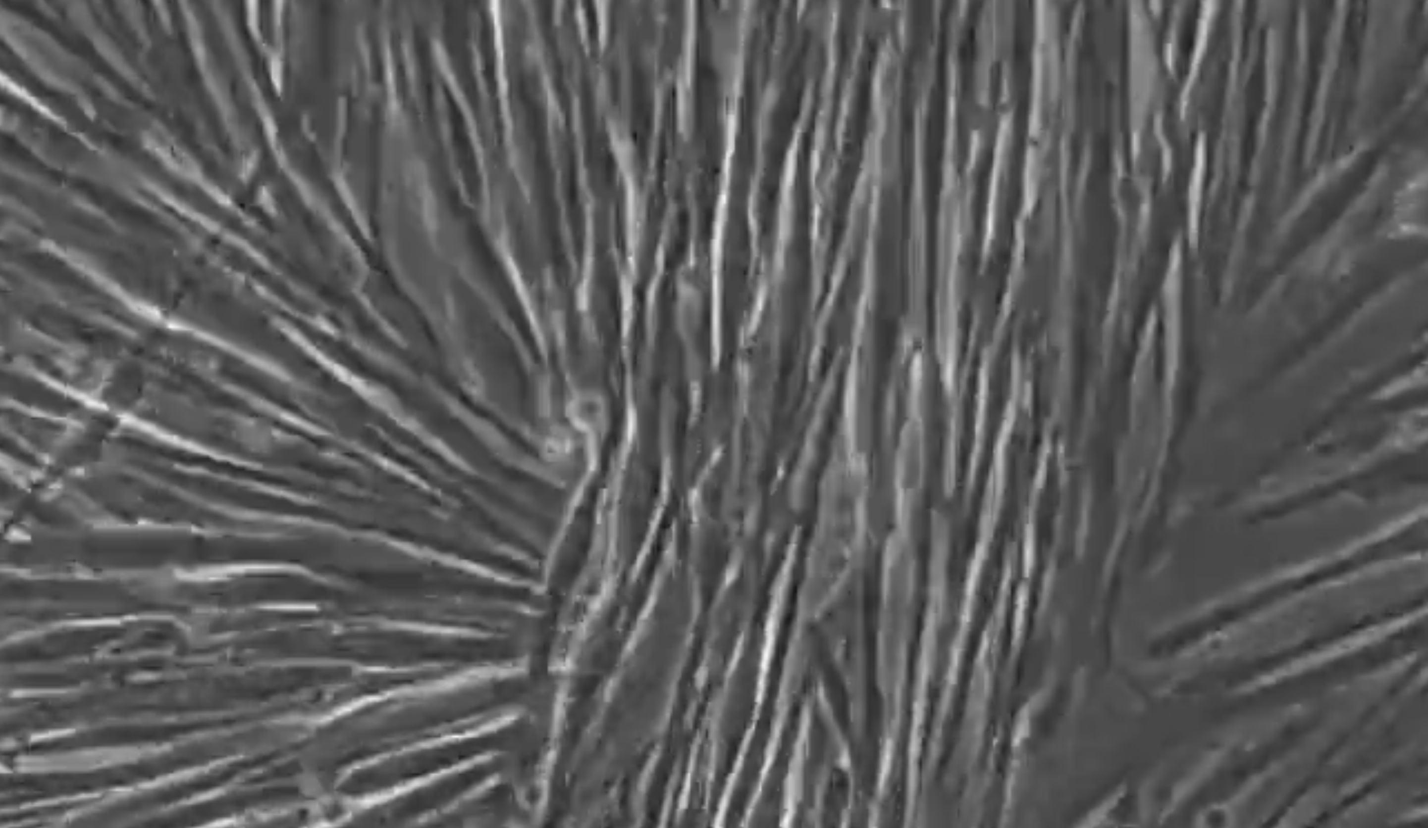 Time-lapse video capturing the rapid and homogeneous skeletal myocytes phenotype acquisition