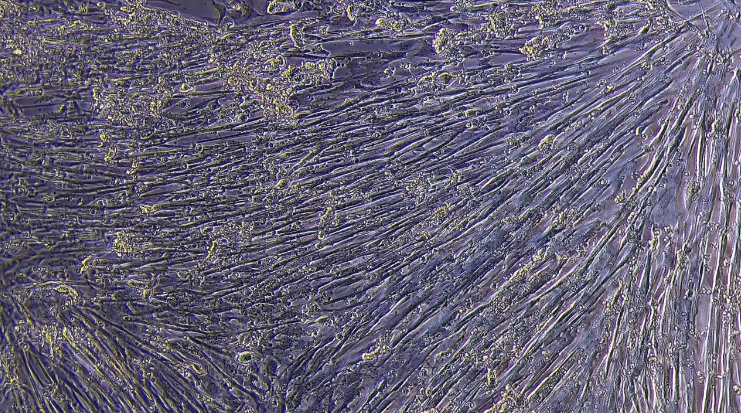 In vitro human muscle cells suitable for contractility assays