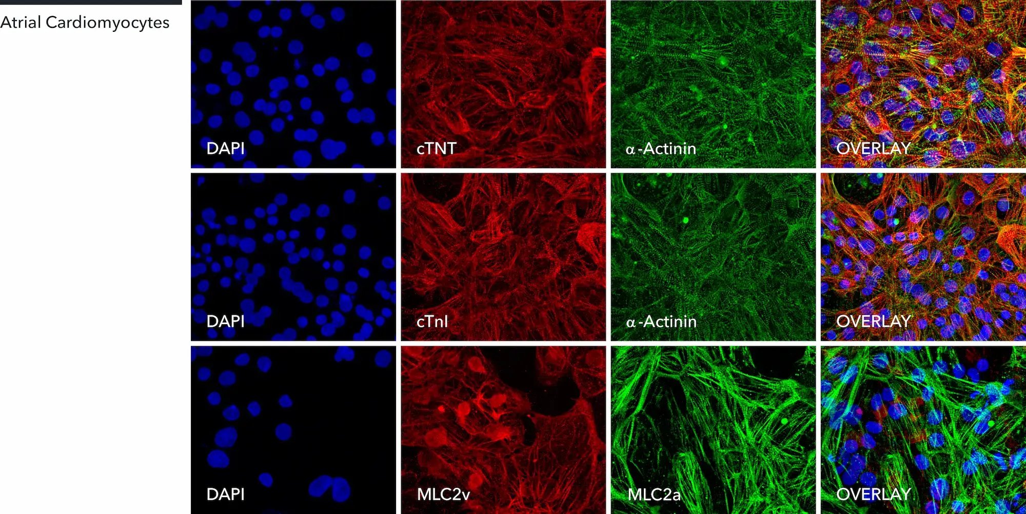 myrcell-atrial-cardiomyocytes-a-actinin-ctnt-ctni-mlc2a