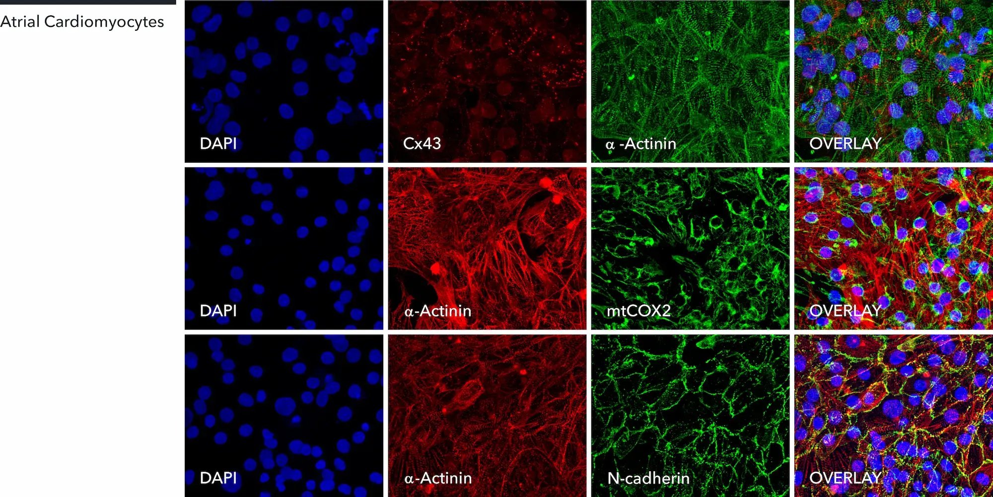 myrcell-atrial-cardiomyocytes-a-actinin-cx43-mtcox2-n-cadherin