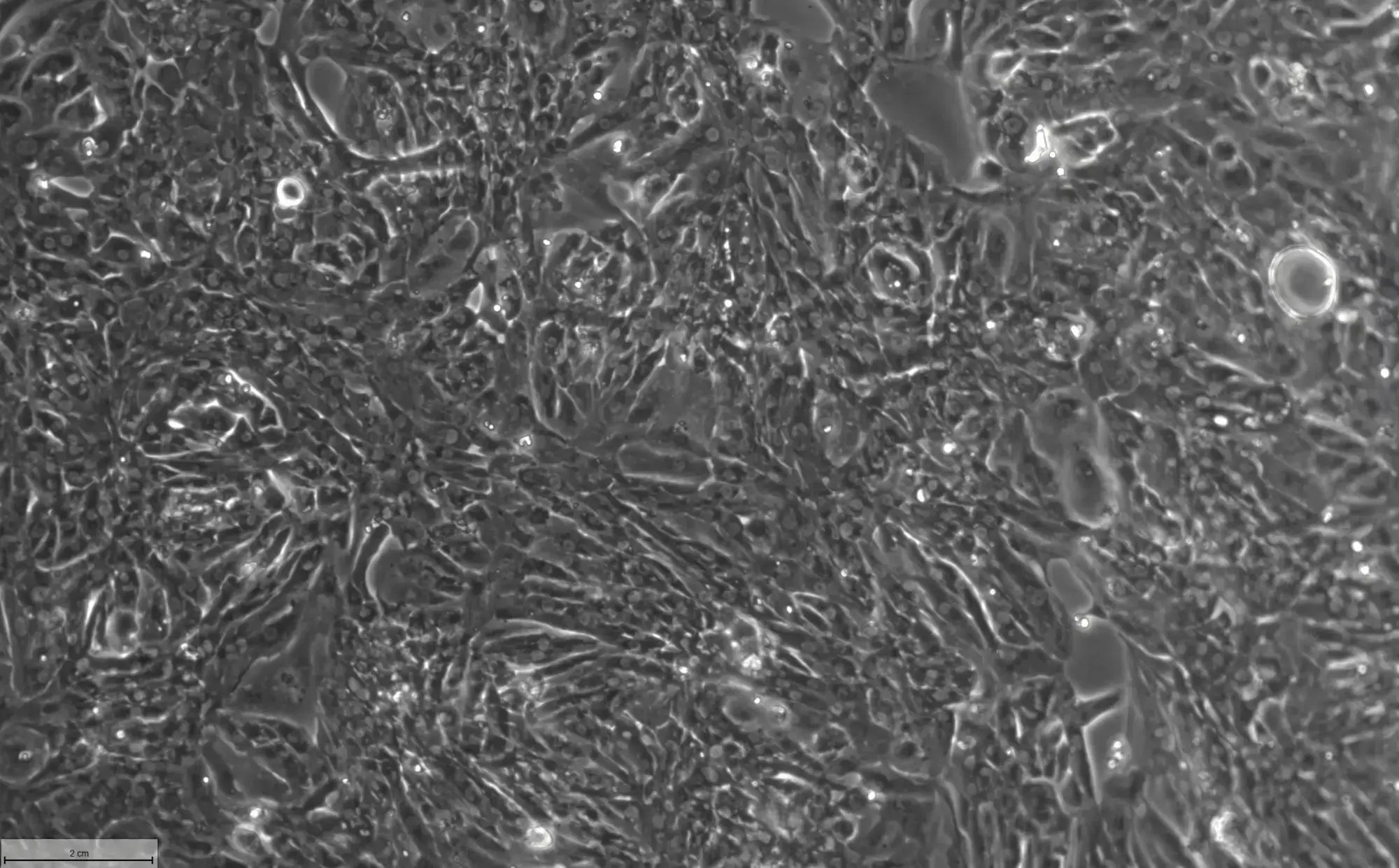 myrcell-atrial-cardiomyocytes-video-thumbnail