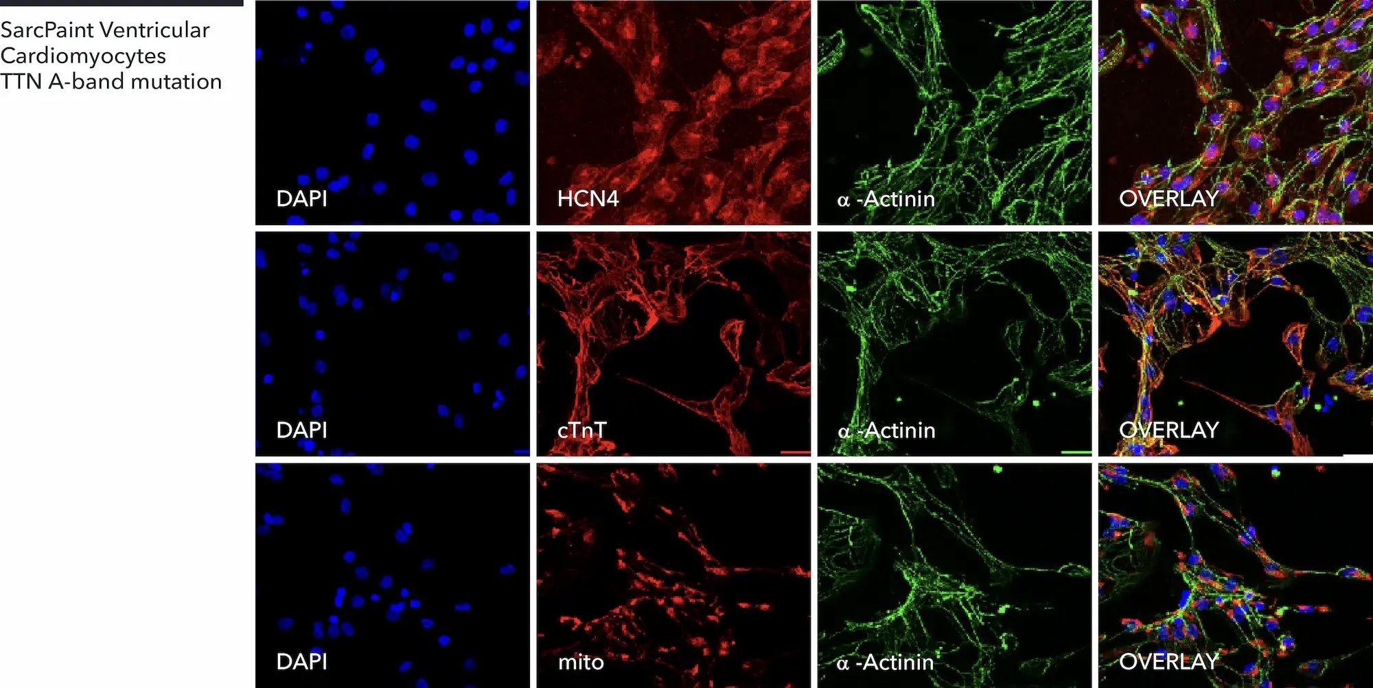 myrcell-sarcpaint-ventricular-cardiomyocytes-ttn-mutation-a-actinin-hcn4-ctnt-mtcox2