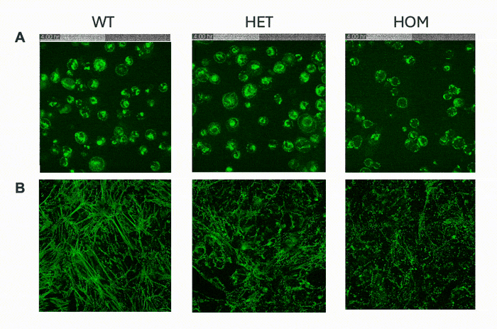 myrcell-sarcpaint-ventricular-cardiomyocytes-ttn-mutation-sarcomere-imaging