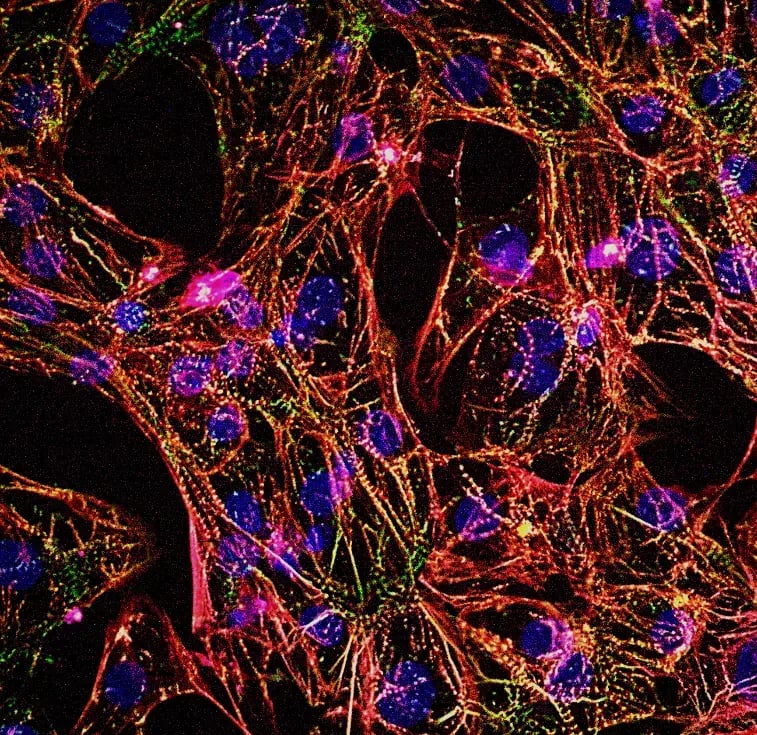 myrCell SarcPaint Ventricular Cardiomyocytes TTN A-band&nbsp;mutation