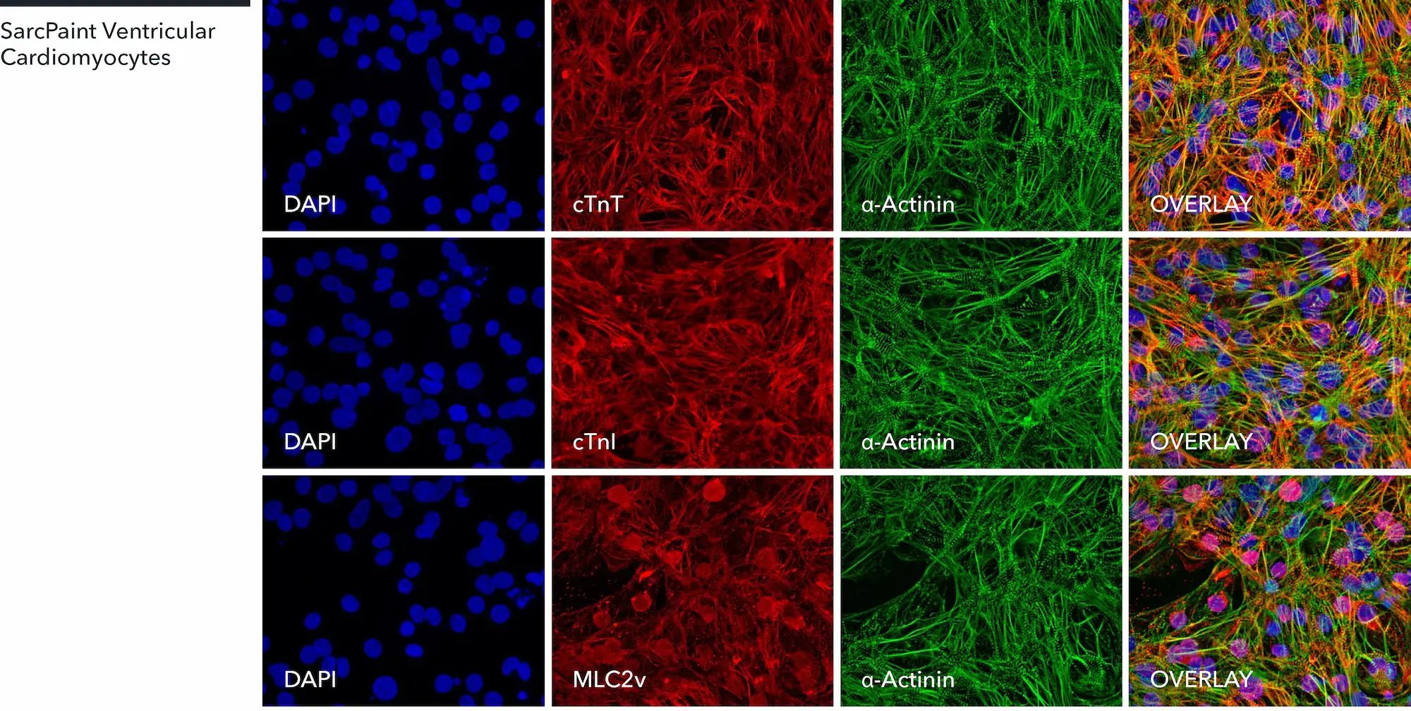 myrcell-sarcpaint-ventricular-cardiomyocytes-icc-ctnt-ctni-mlc2v