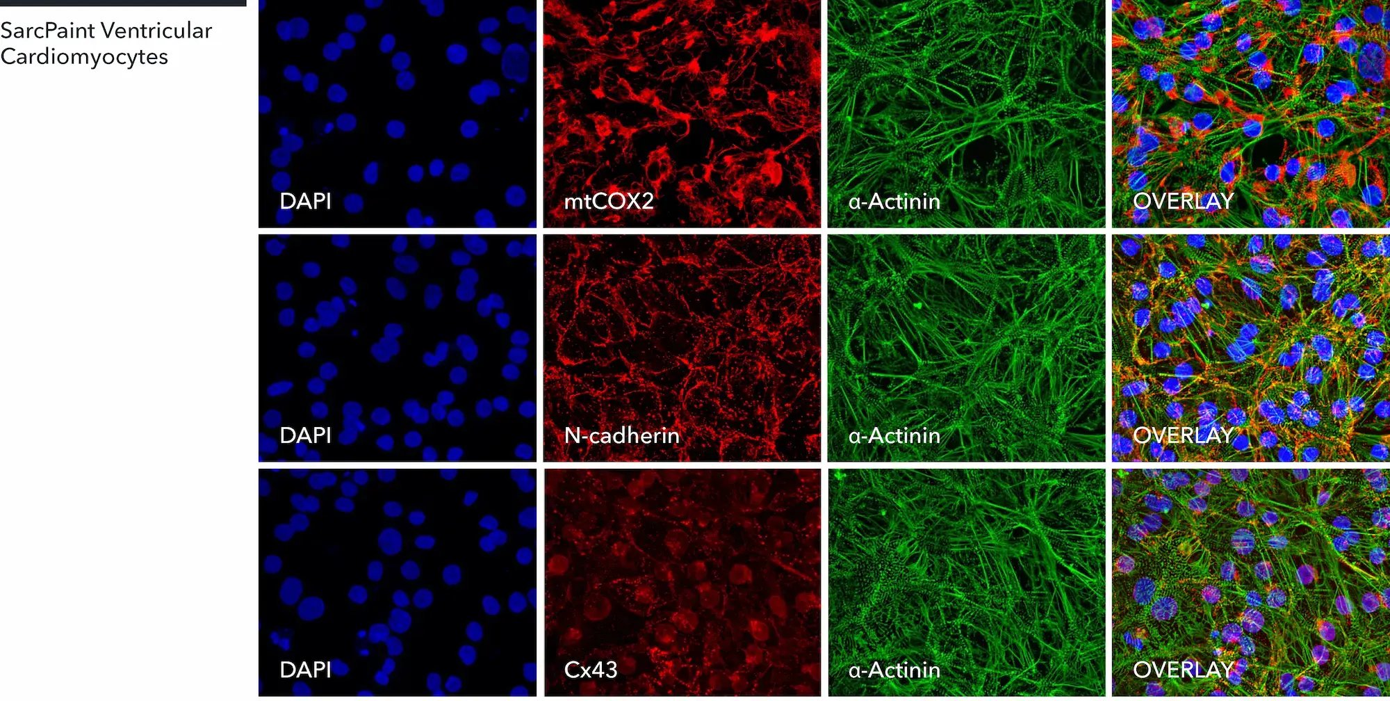 myrcell-sarcpaint-ventricular-cardiomyocytes-icc-mtcox2-n-cadherin-cx43