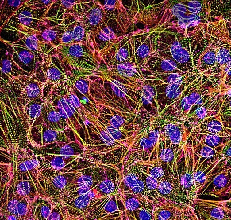 myrCell SarcPaint Ventricular Cardiomyocytes