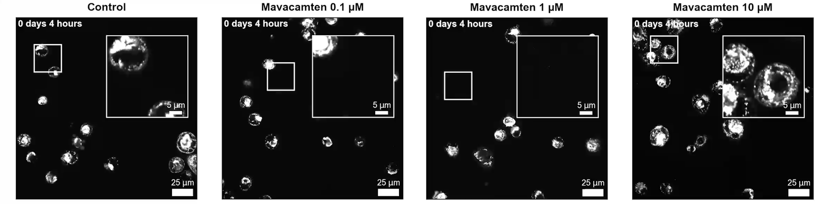 myrcell-ventricular-cardiomyocyte-sarcpaint-drug-induced-sarcomere-remodelling-video-1x4