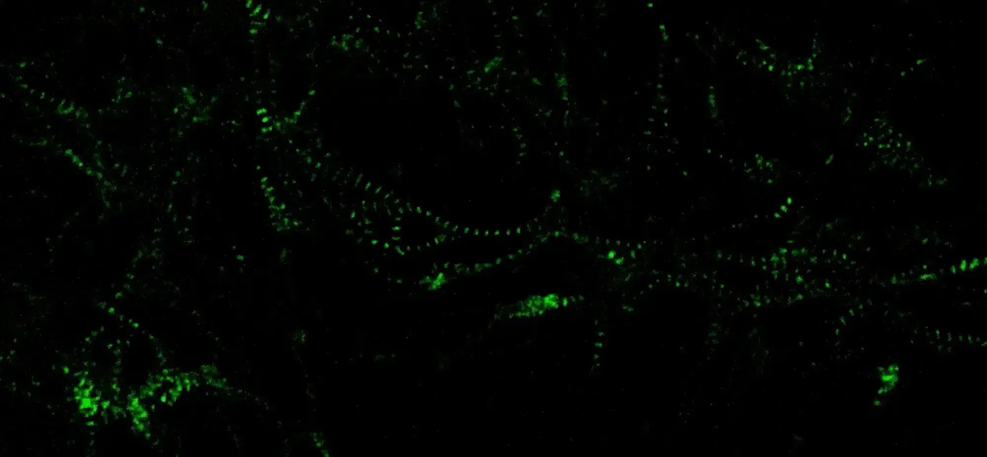 myrcell-ventricular-cardiomyocyte-sarcpaint-live-imaging-60x