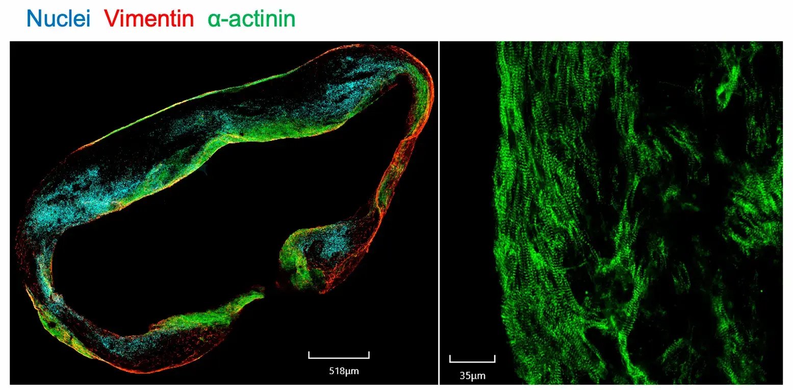 myrcell-ventricular-cardiomyocytes-sarcpaint-ehm-protein-expression