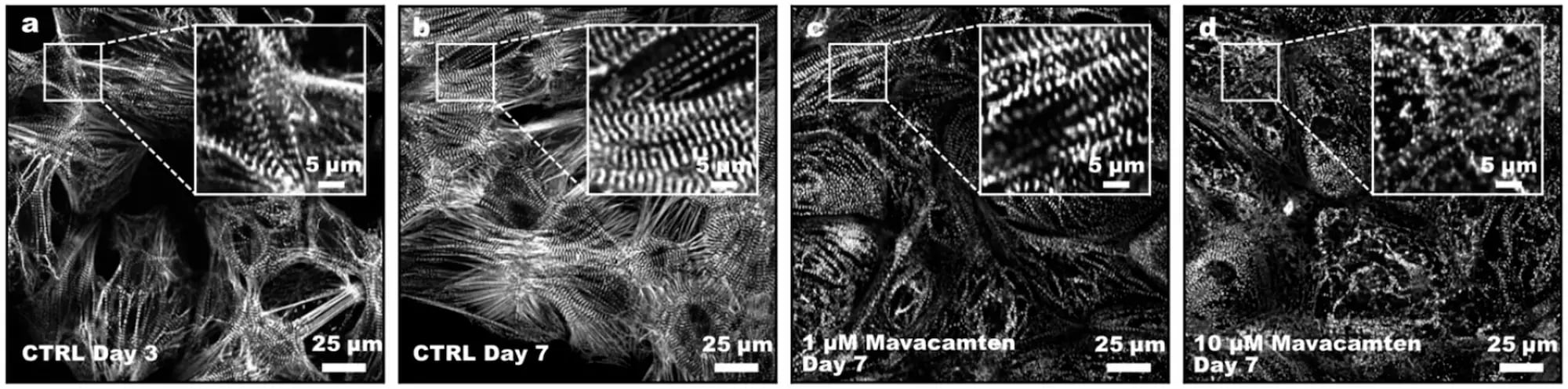 myrcell-ventricular-cardiomyocyte-sarcpaint-sarcomere-remodelling