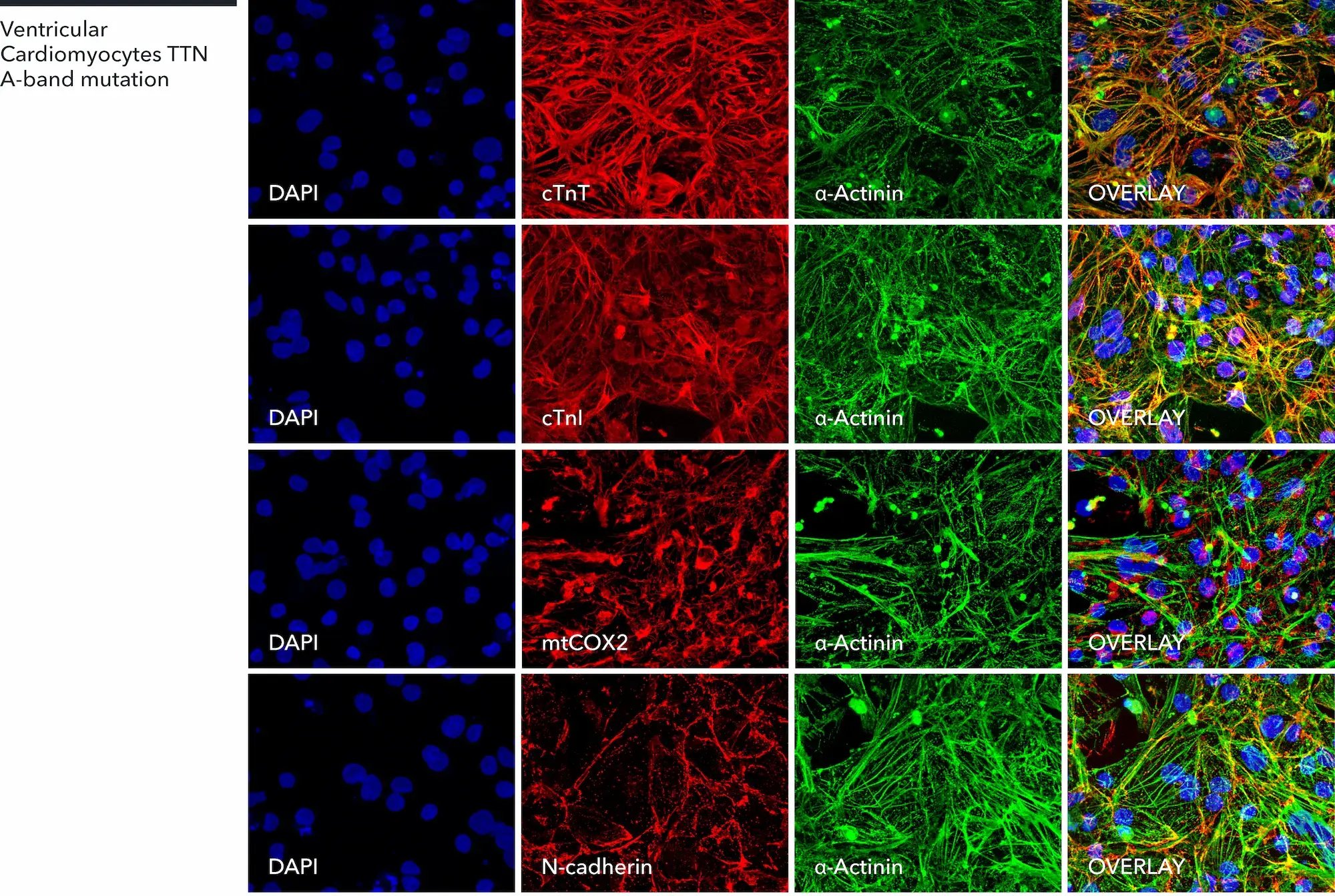 myrcell-ventricular-cardiomyocytes-ttn-mutation-a-actinin-ctnt-ctni-mtcox2-n-cadherin