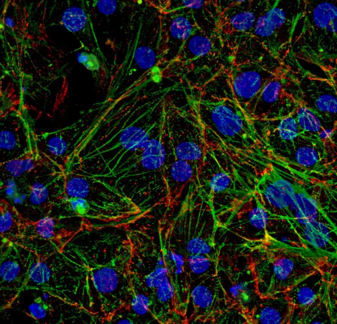 myrcell-ventricular-cardiomyocytes-ttn-mutation-icc-alpha-actinin-n-cadherin-dapi