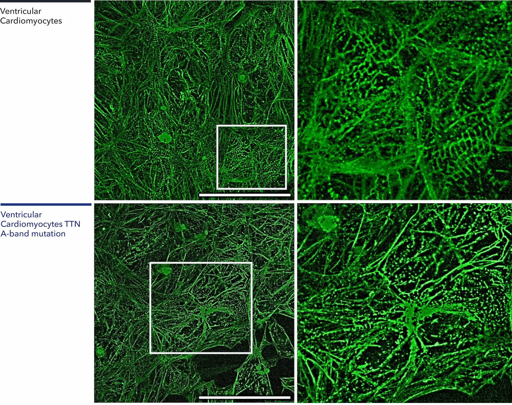 myrcell-ventricular-cardiomyocytes-ttn-mutation-sarcomere-imaging