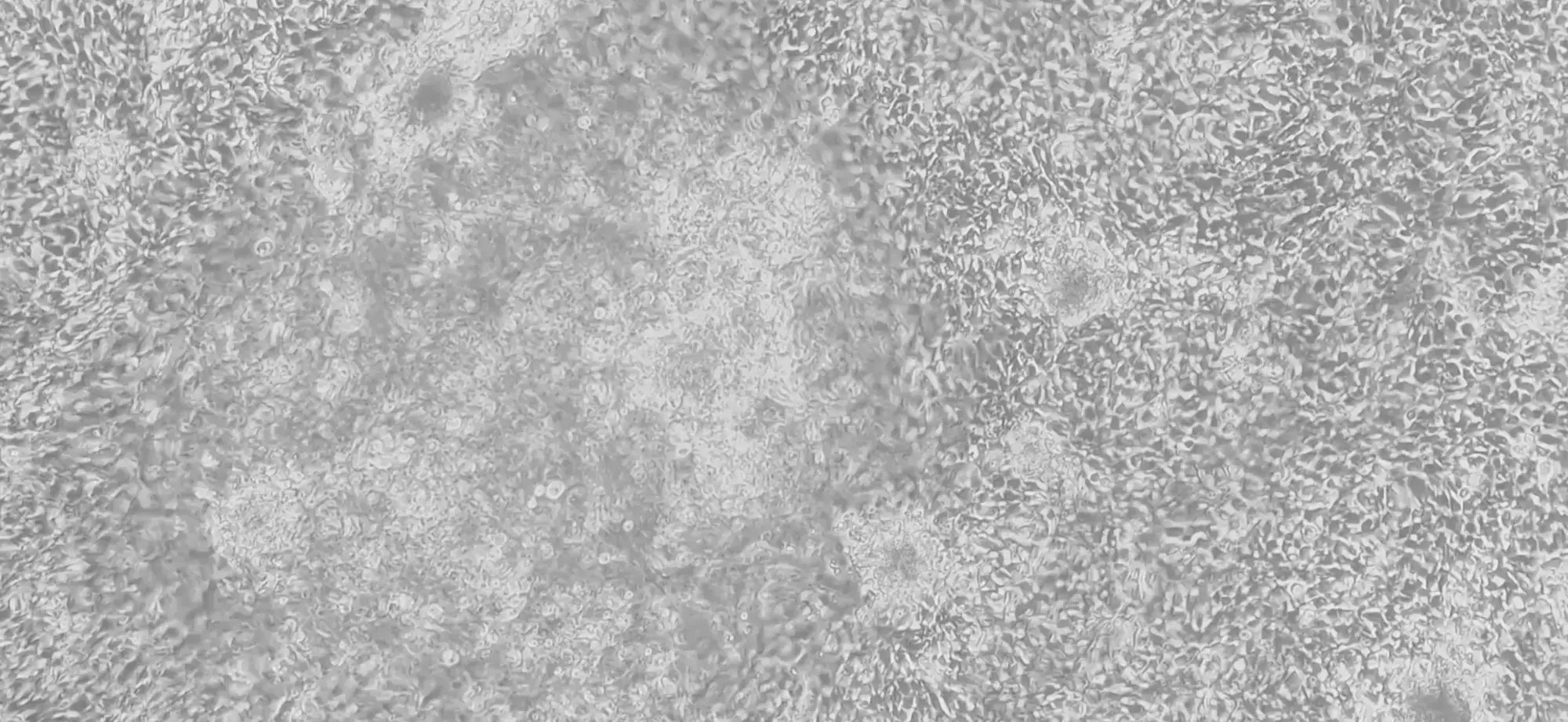 myrCell-ventricular-cardiomyocytes-synchronised-beating