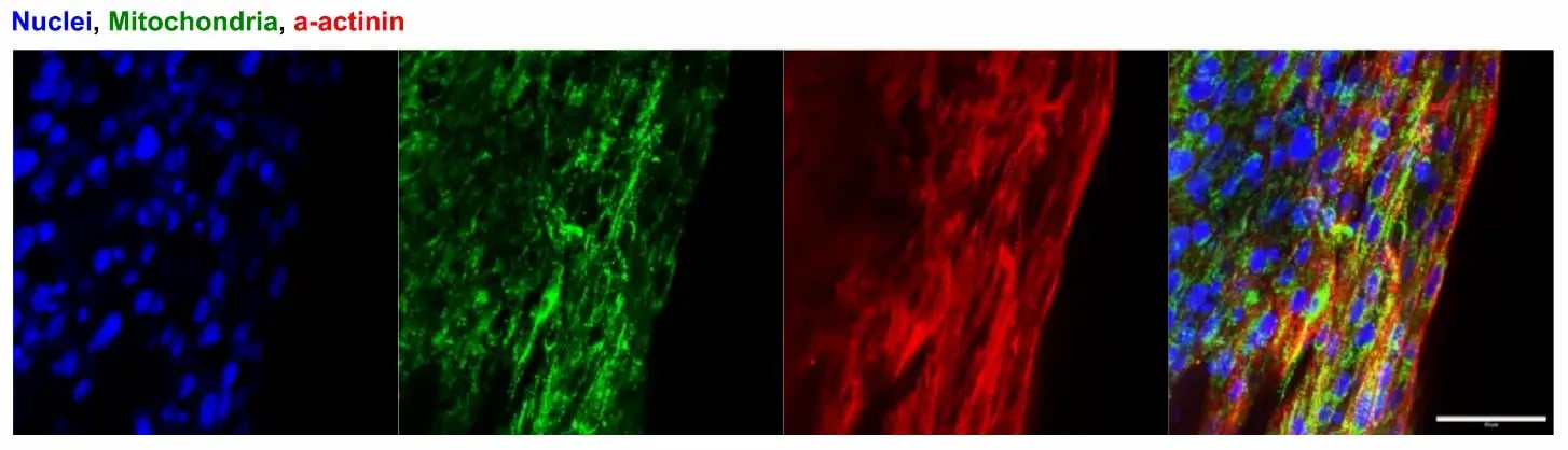 myrcell-cardiomyocytes-ehm-protein-expression-mito-actinin
