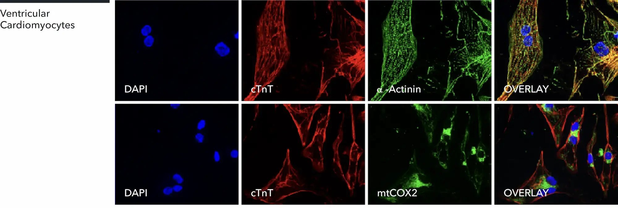 myrcell-ventricular-cardiomyoctyes-protein-expression-ctnt-mtcox2