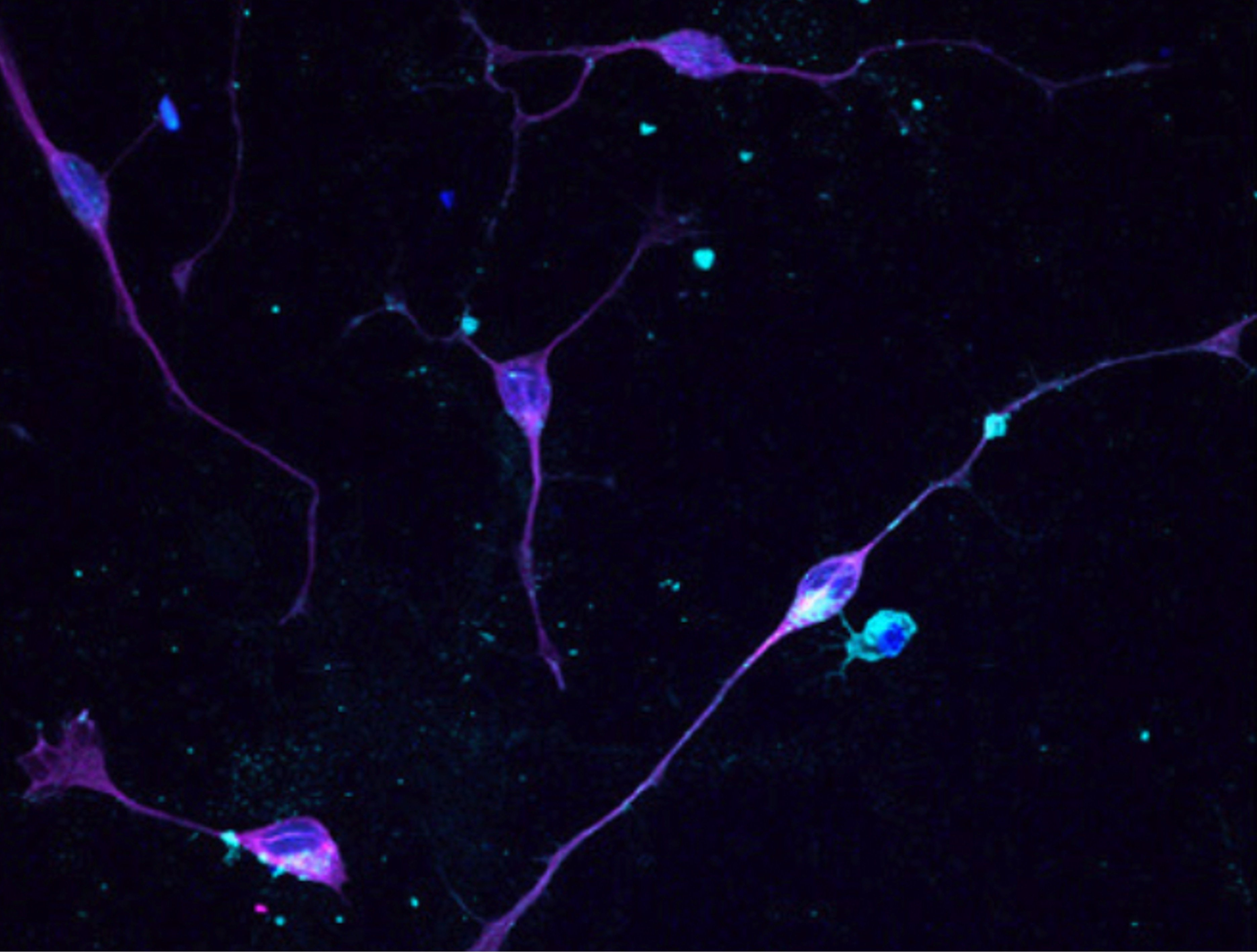 Interferon-γ exposure of human iPSC-derived neurons alters major histocompatibility complex I and synapsin protein expression