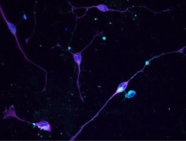 Studying Neurodevelopmental Disorders with Stem Cells | Publication
