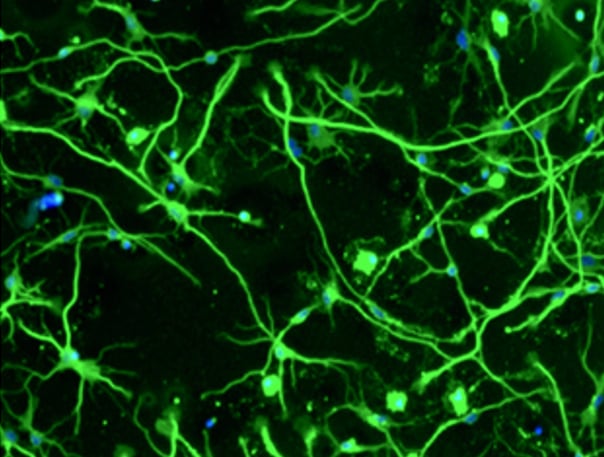 Compounds co-targeting kinases in axon regulatory pathways promote regeneration and behavioral recovery after spinal cord injury in mice