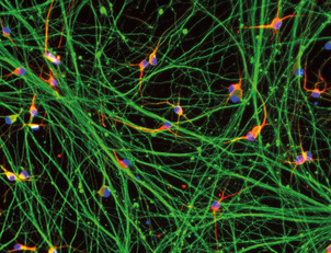 ioGlutamatergic Neurons HTT 50CAG/WT