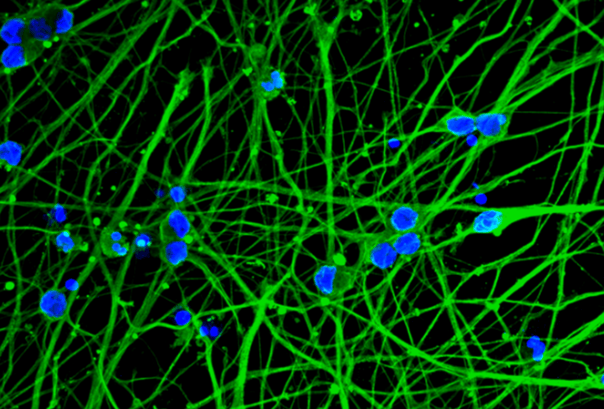 Precision Cellular Reprogramming for Scalable and Consistent Human Neurodegenerative Disease Models