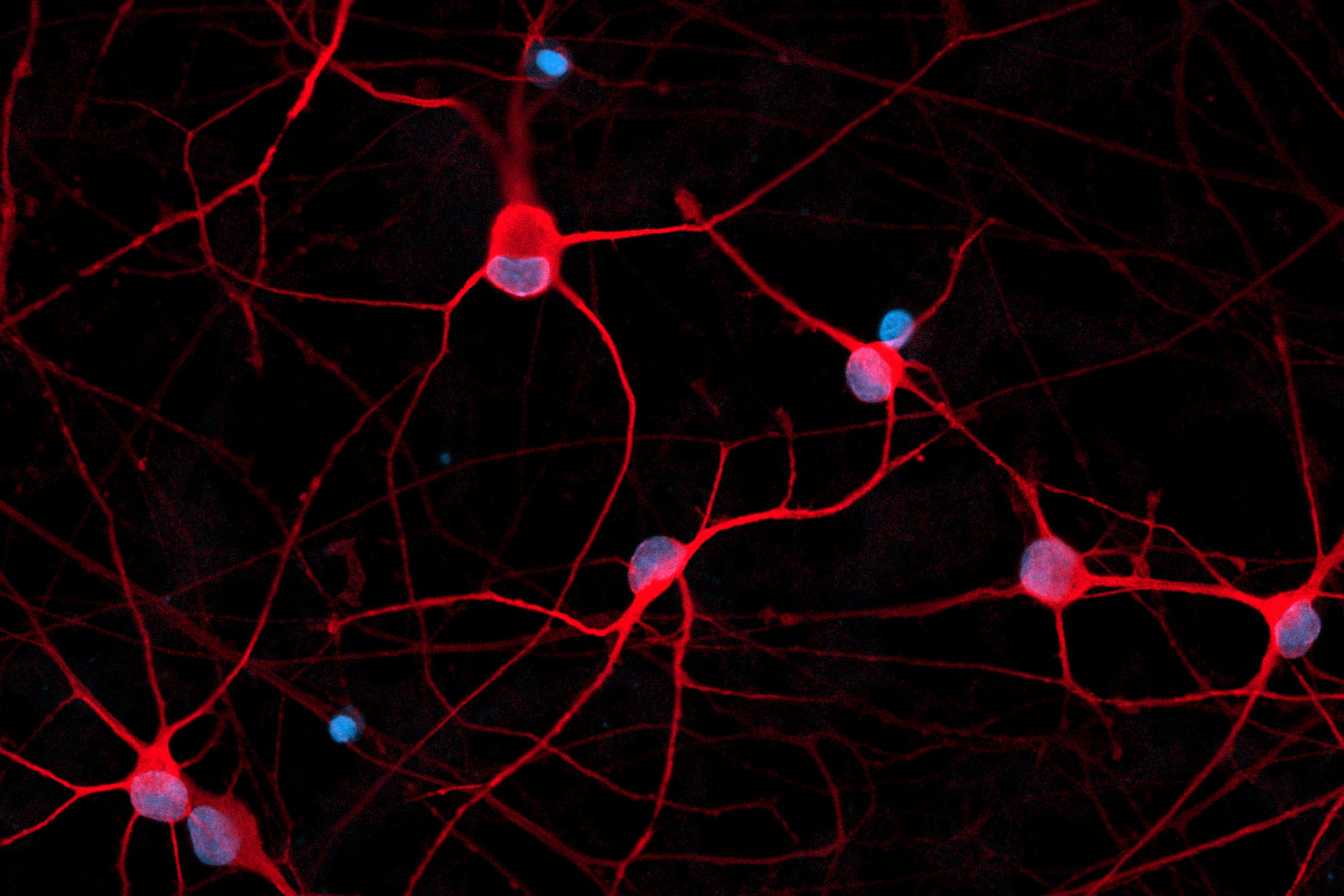 RNA-sequencing workshop Top tips for human iPSC-derived cells