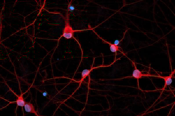 RNA-sequencing workshop Top tips for human iPSC-derived cells
