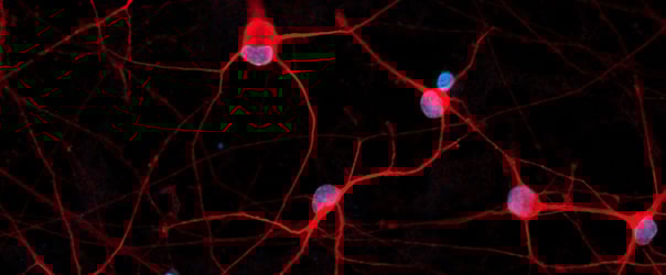 Mastering Cell Identity In A Dish: The Power Of Cellular Reprogramming