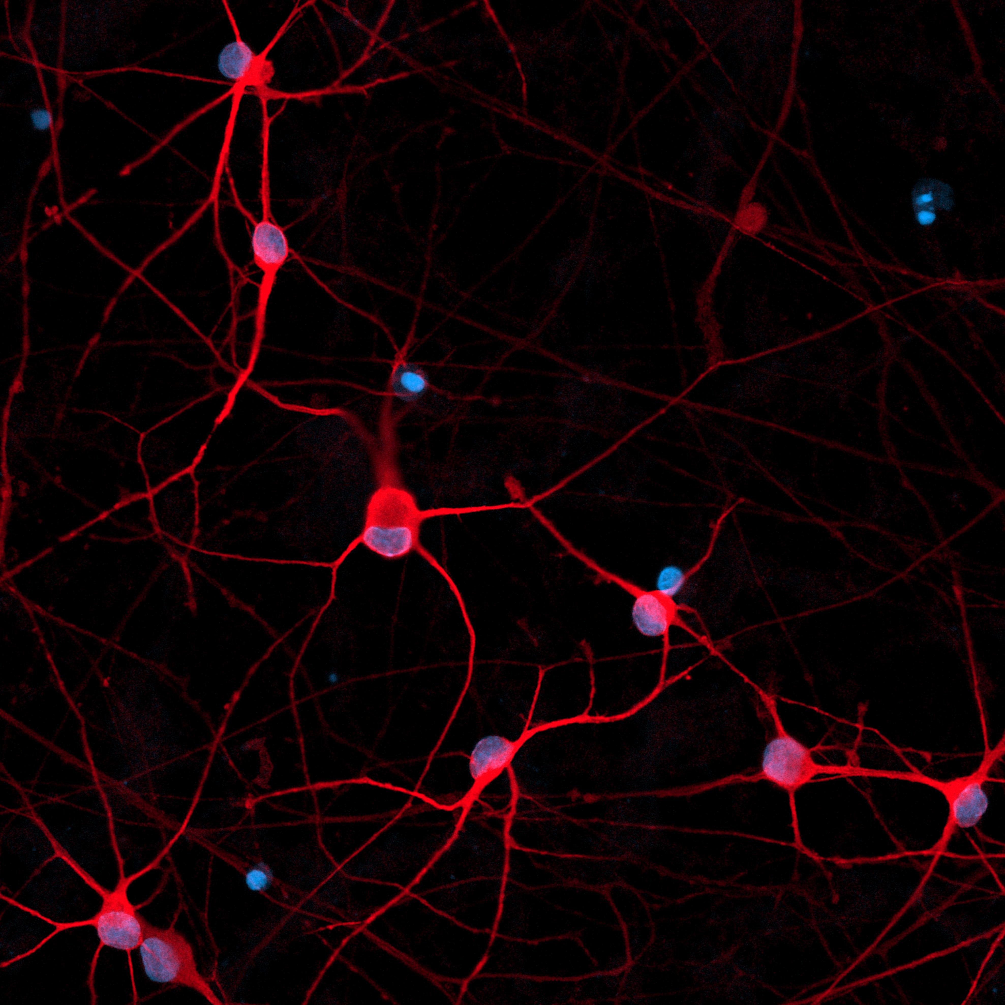 Mastering Cell Identity in a Dish: The Power of Cellular Reprogramming