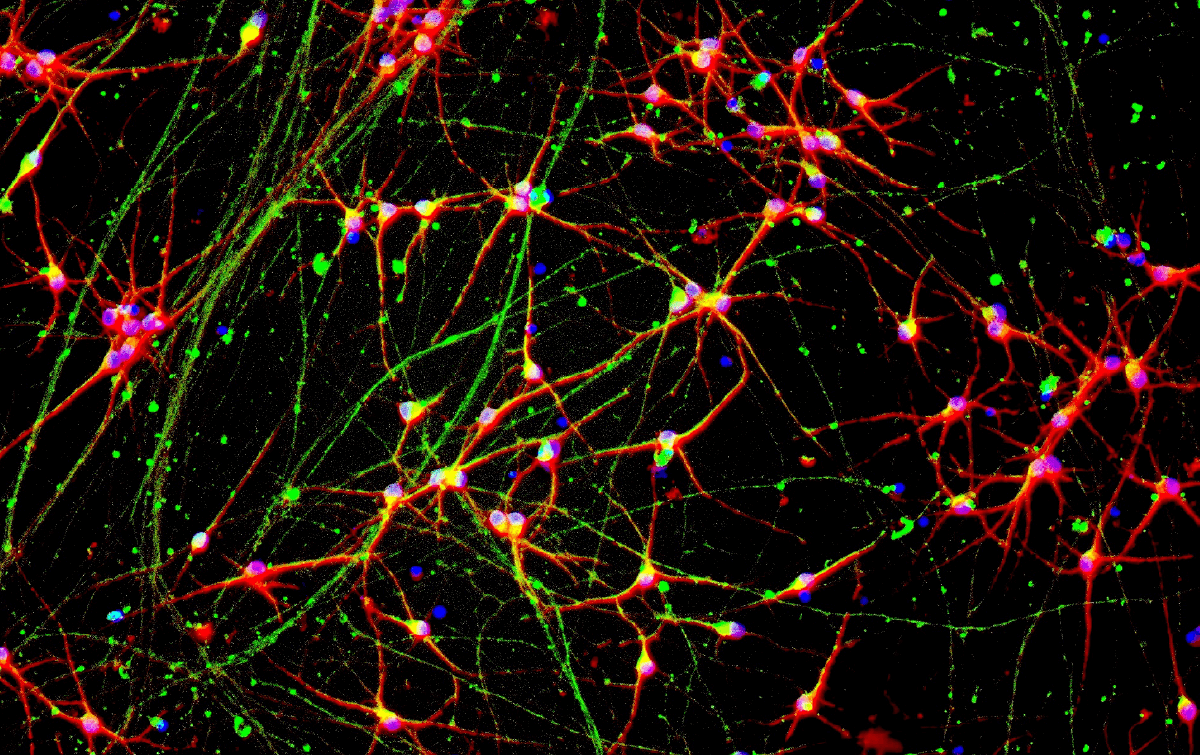 Running Large-scale CRISPR Screens in Human Neurons