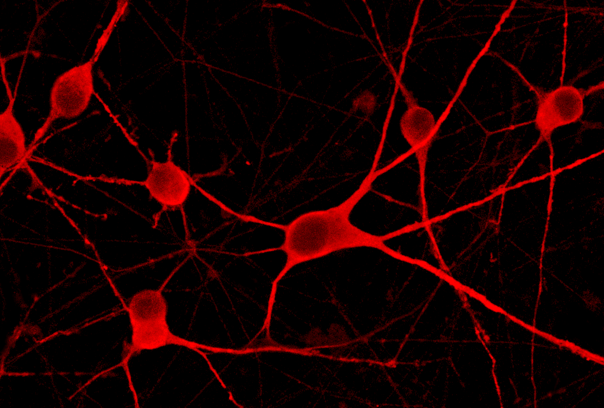 Harnessing AI-guided visual biology to discover drug targets for neurodegenerative disease
