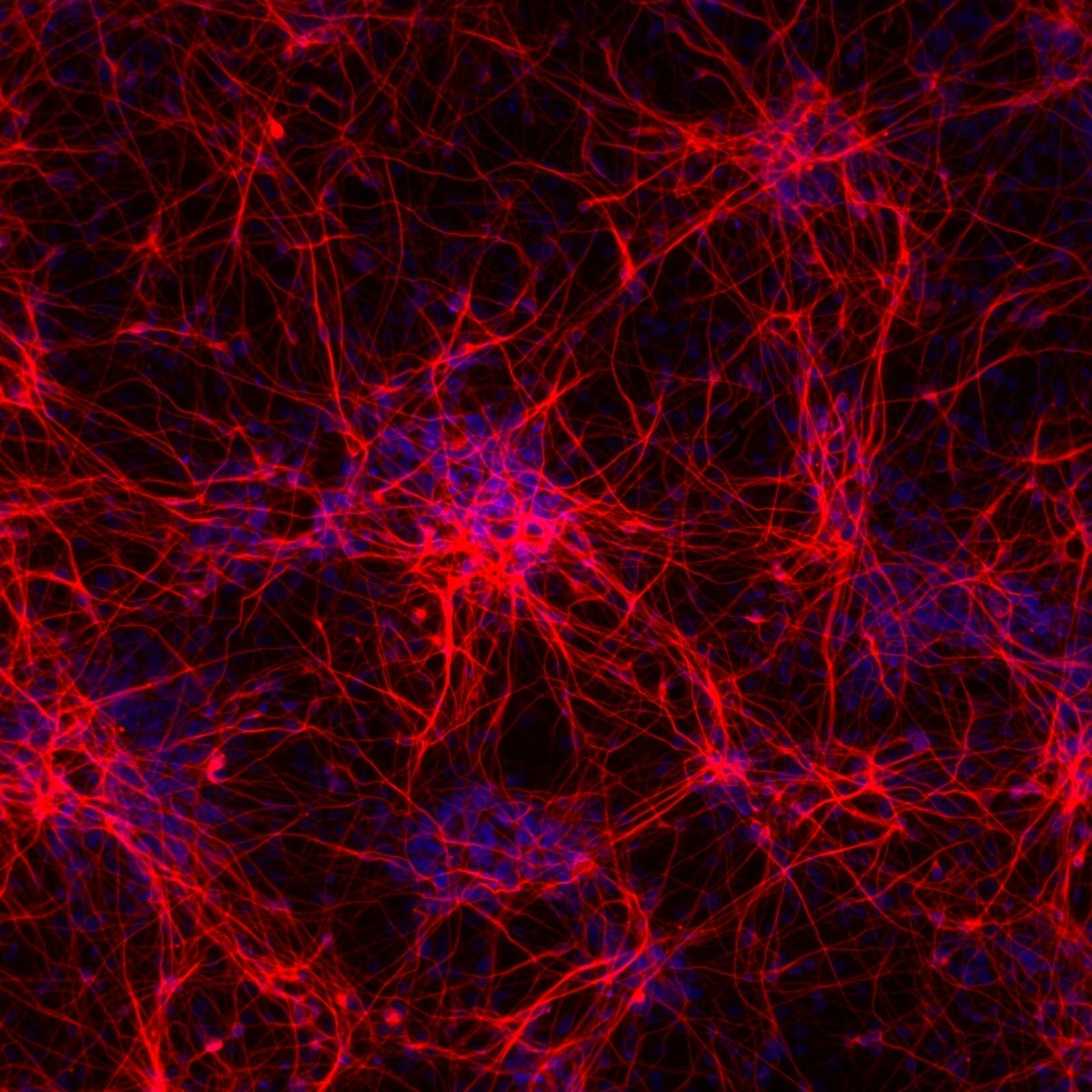 ioGlutamatergic Neurons and related disease models