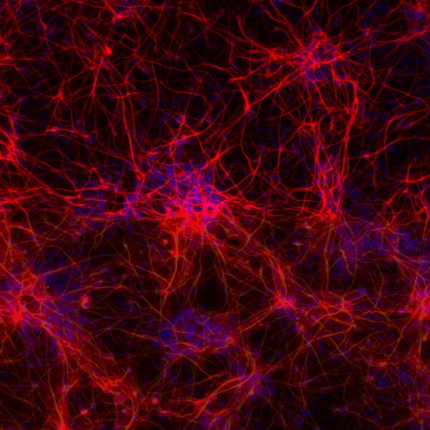 ioGlutamatergic Neurons Wild Type and related disease models | User Manual