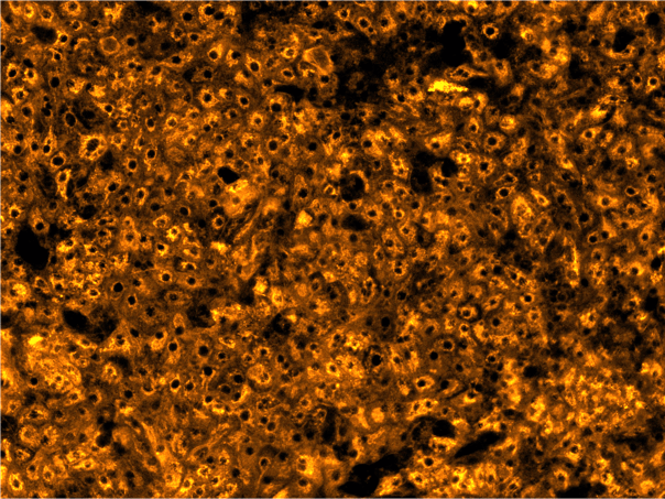 bit.bio launches Early Access programme for ioHepatocytes, a new iPSC-derived liver model