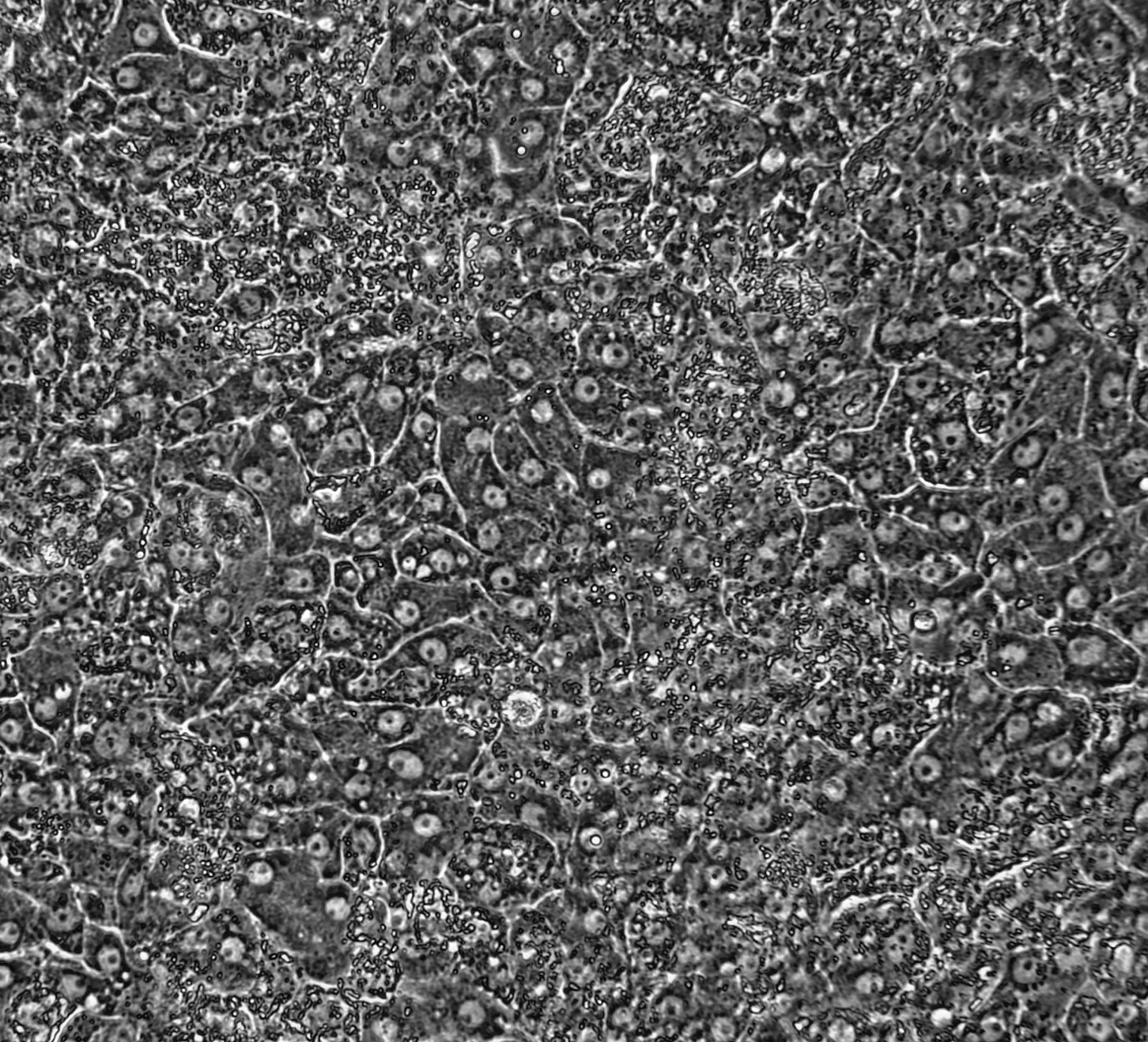 ioHepatocytes_Discovery_Research_D14_morphology