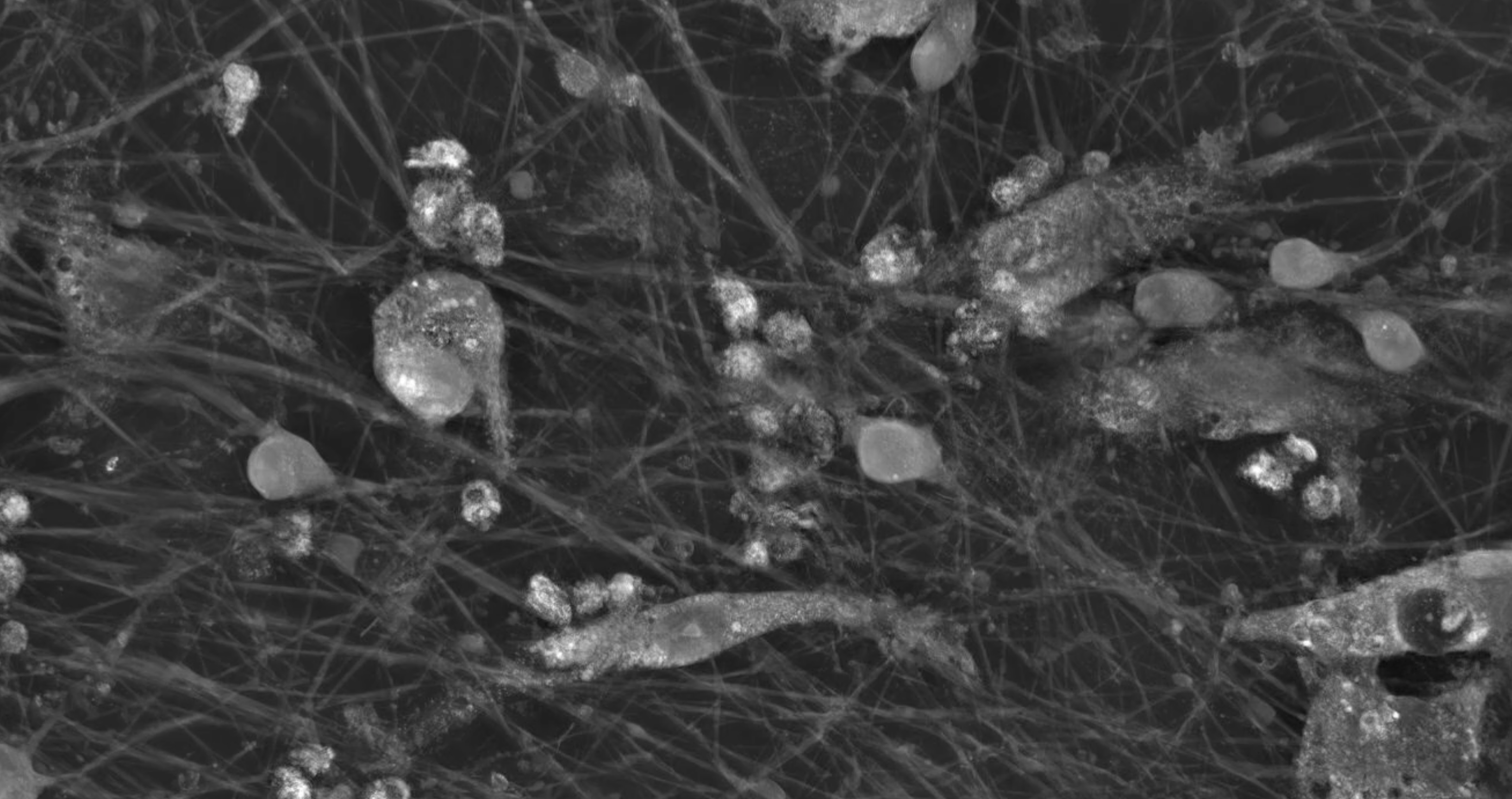 Co-cultures of microglia and glutamatergic neurons, morphology video