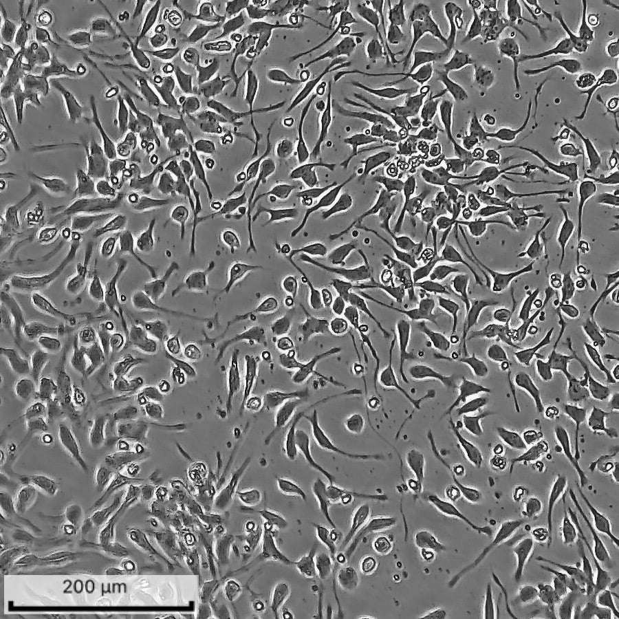 ioGABAergic Neurons Brightfield Day 1