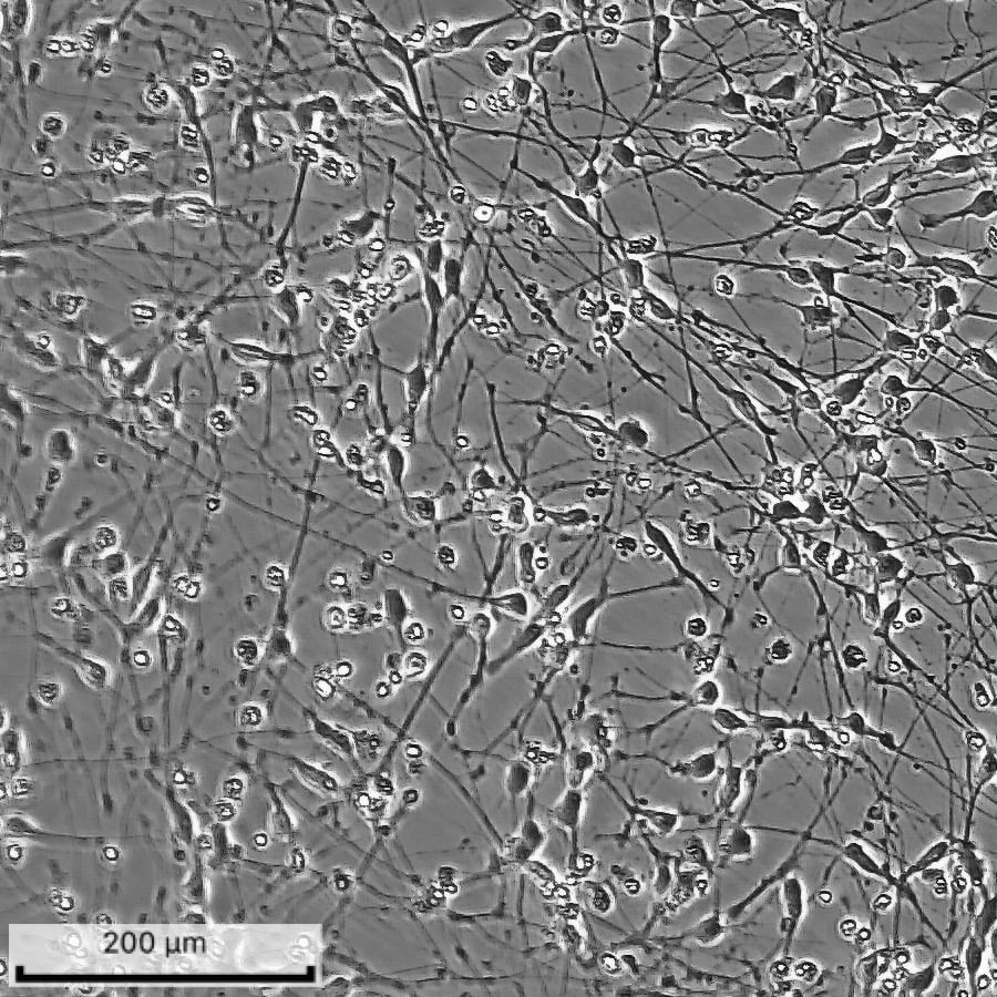 ioGABAergic Neurons Day 12 Brightfield