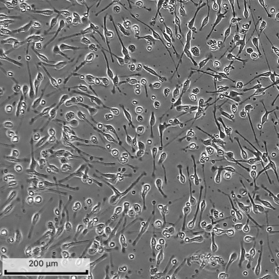 ioGABAergic Neurons Day 3 Brightfield