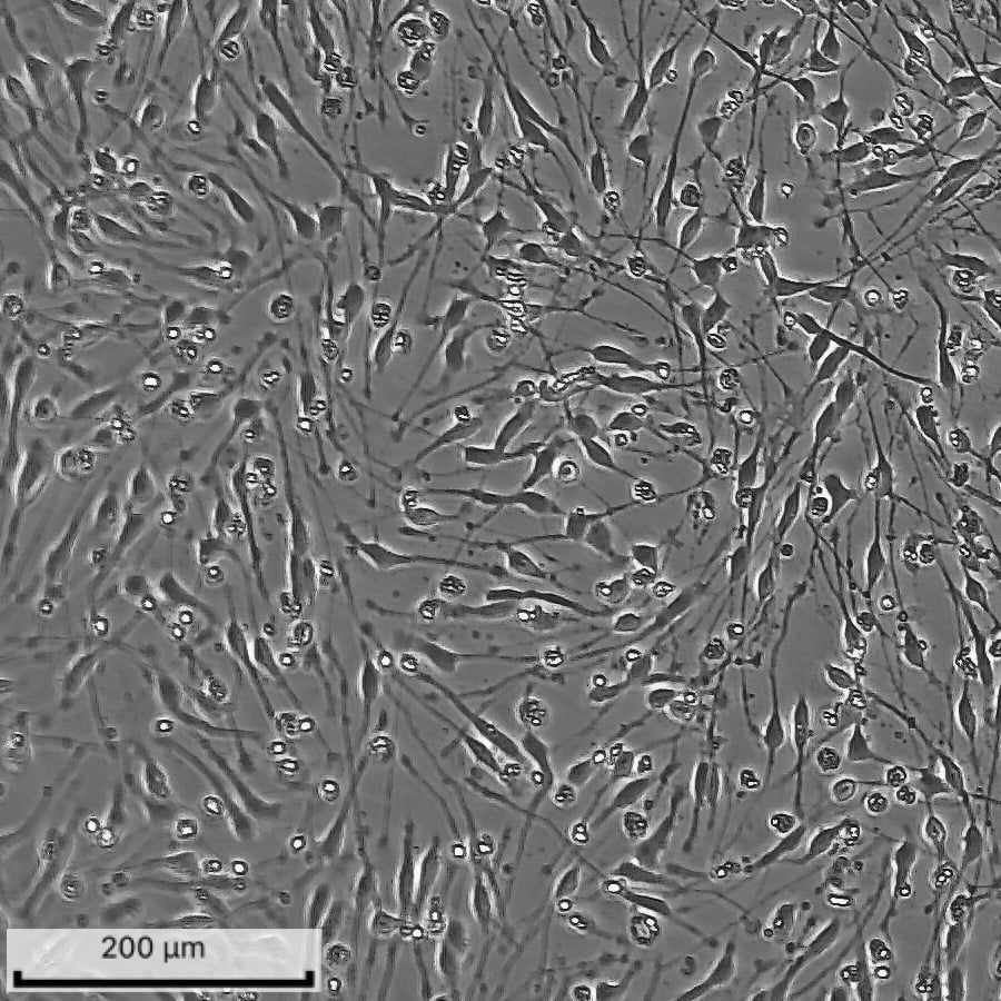 ioGABAergic Neurons Day 7 Brightfield