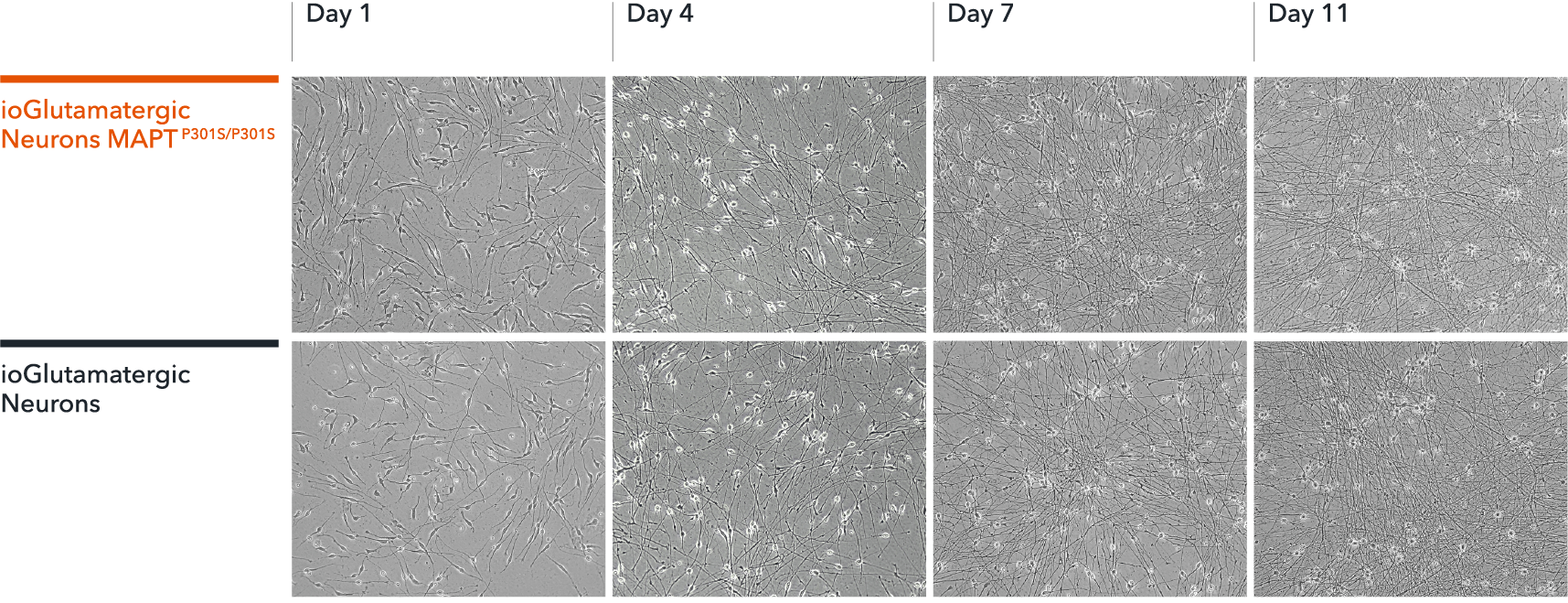 ioGlutamatergic Neurons MAPT P301S/P301S Brightfield images