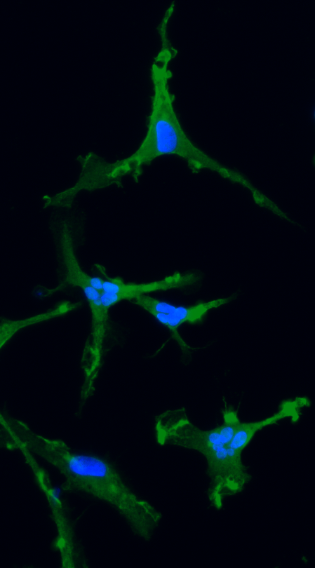 ioMicroglia APOE 4/3 C112R/WT™