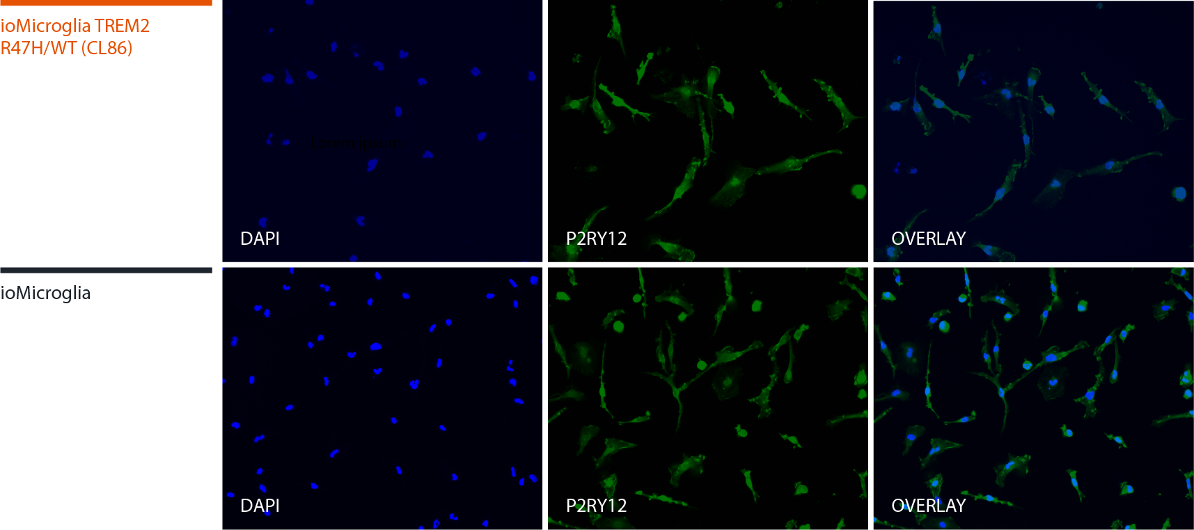 ioMicroglia TREM2 R47H Het P2RY12 panel FINAL