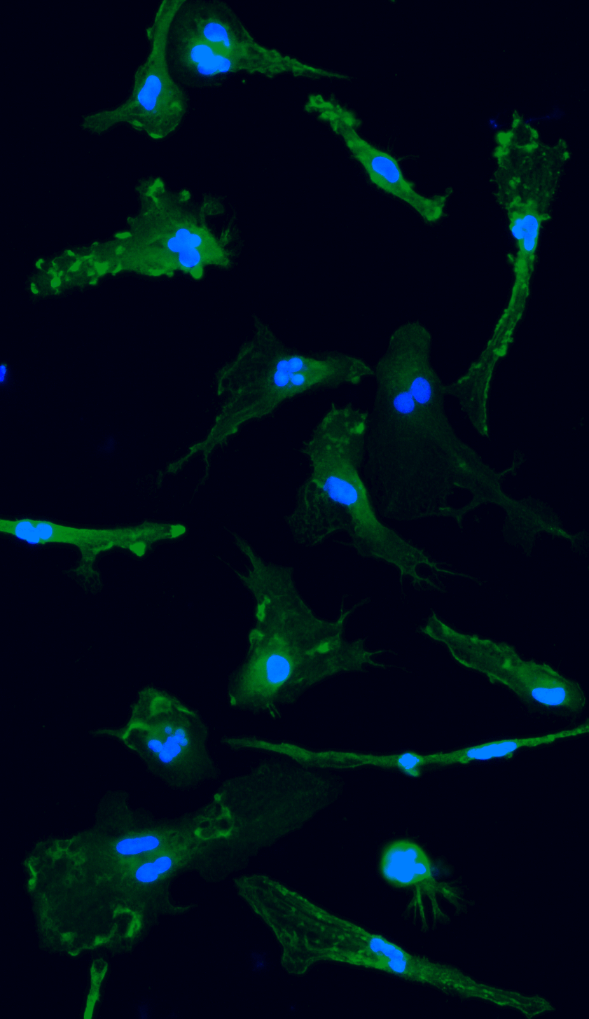 ioMicroglia TREM2 R47H Het hero image compressed FINAL2