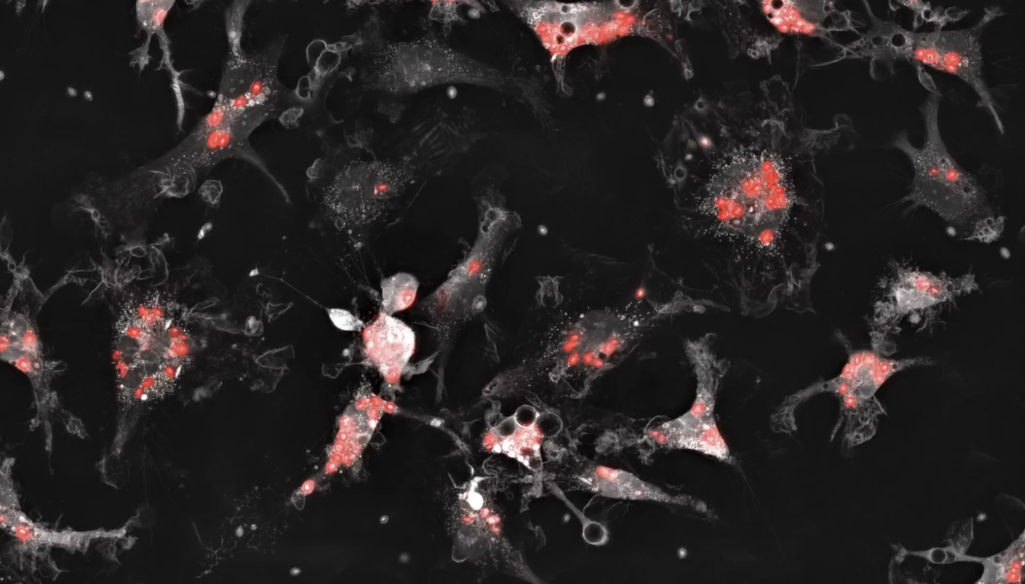 Representative video showing human microglial cells phagocytosing pHrodo Red labelled Zymosan particles.